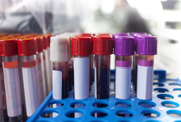 How Long Does A Metabolic Blood Test Take